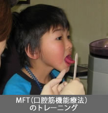 MFT（口腔筋機能療法）のトレーニング