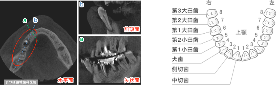 歯周病治療への応用画像